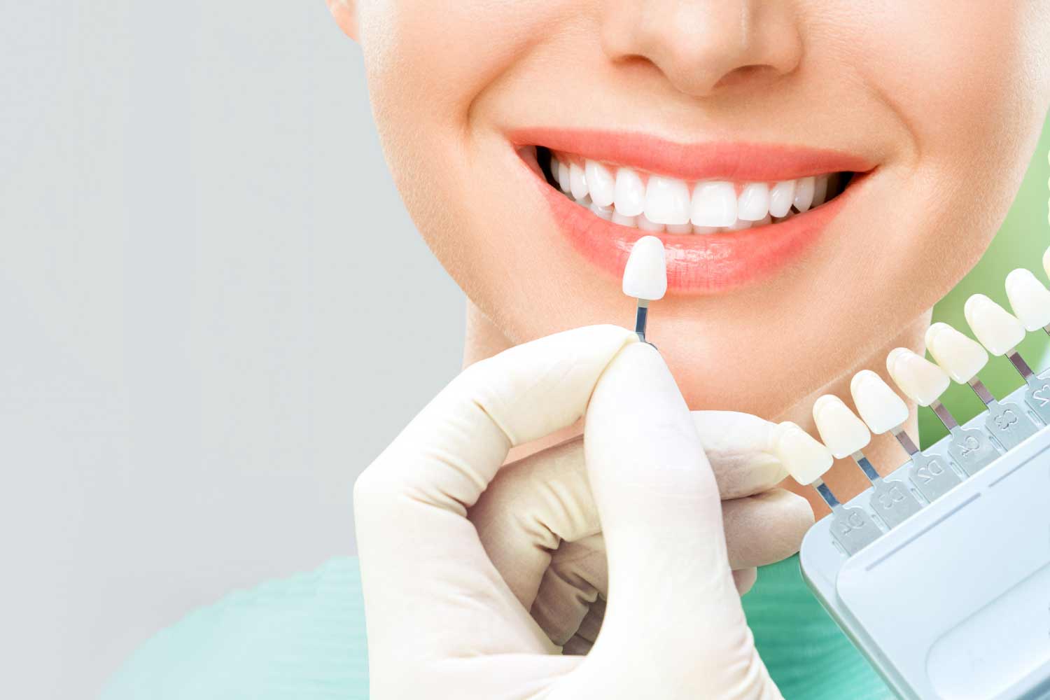 blanqueamiento-dental-con-caries