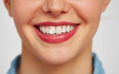 ¿Por qué tengo manchas blancas en los dientes?