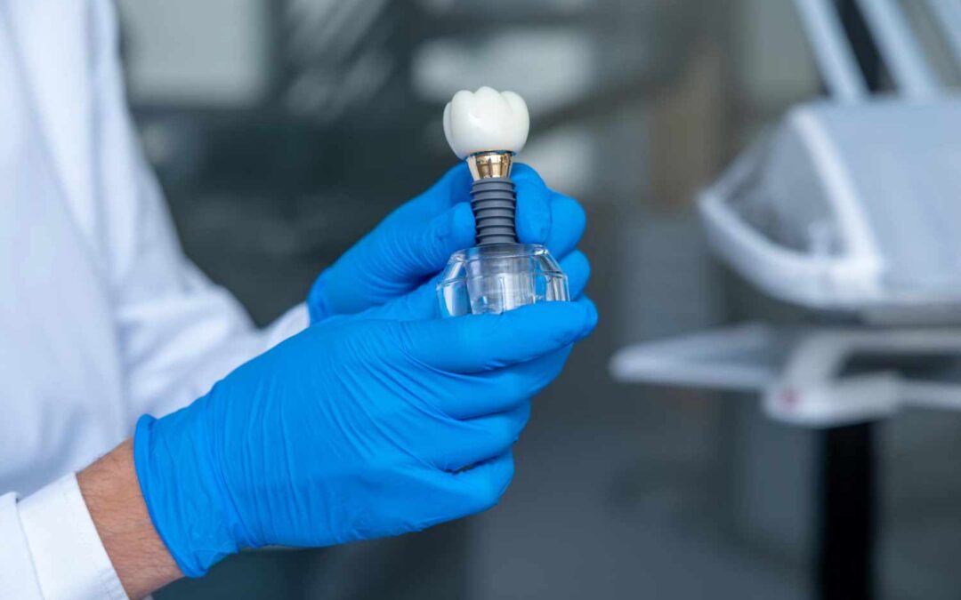 Implantes dentales en Vitoria: todo lo que debes saber