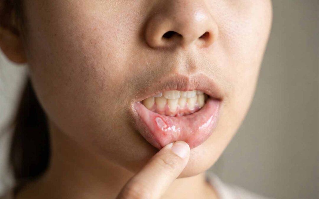 Persona tocándose el labio por dentro con ligera molestia, sin heridas visibles.