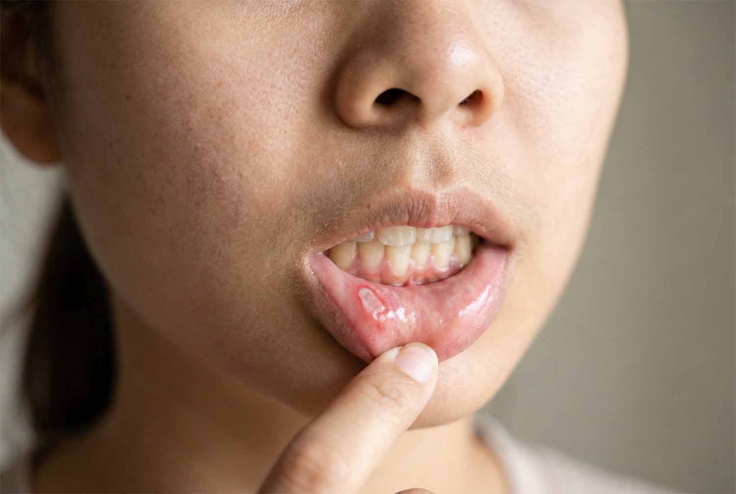 Persona tocándose el labio por dentro con ligera molestia, sin heridas visibles.