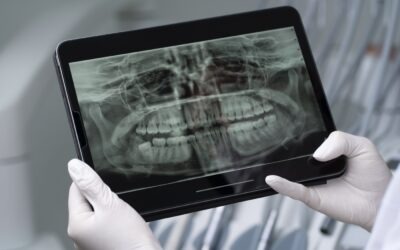 Escáner intraoral en Vitoria: qué es, para qué sirve y cómo mejora tu tratamiento dental
