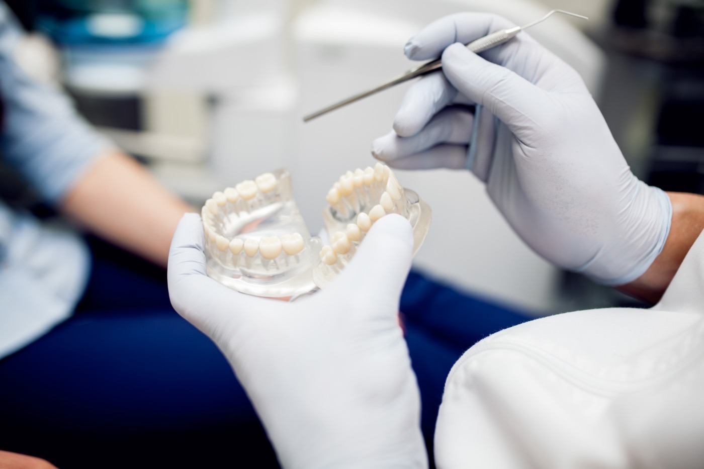 Implante dental de carga inmediata en Vitoria-Gasteiz Clínica Pérez Belmonte