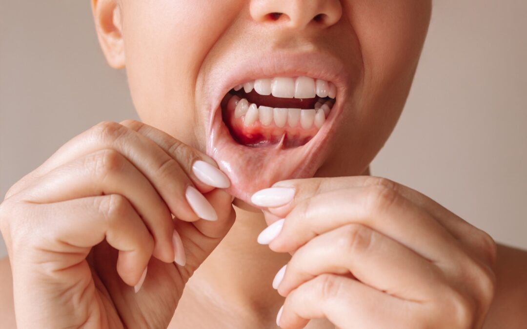 Periodoncia en Vitoria-Gasteiz: por qué las encías sanas son la base de tu sonrisa